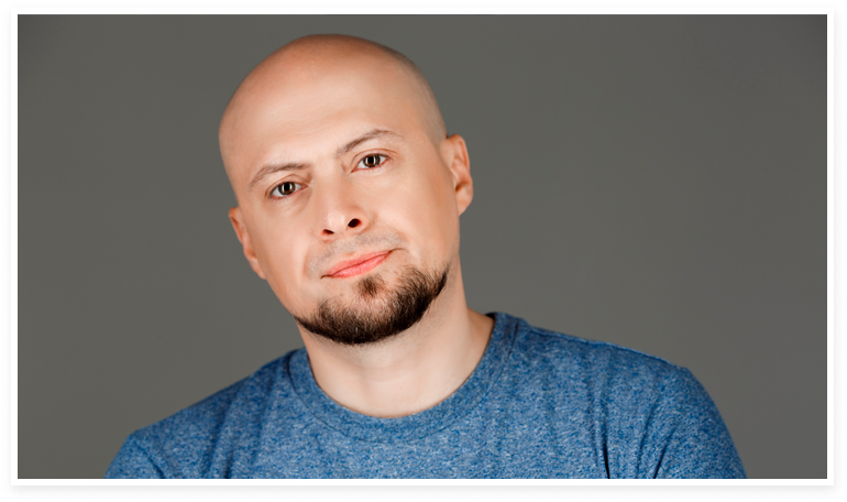 La alopecia temprana es aquella que se manifiesta, generalmente, antes de los 30 años.