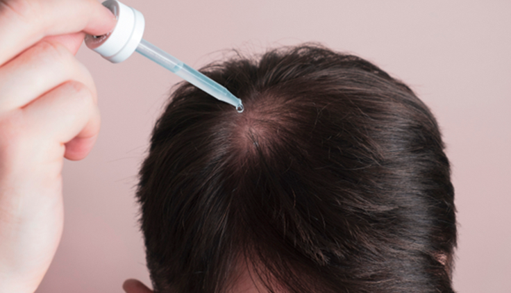 frasco de minoxidil