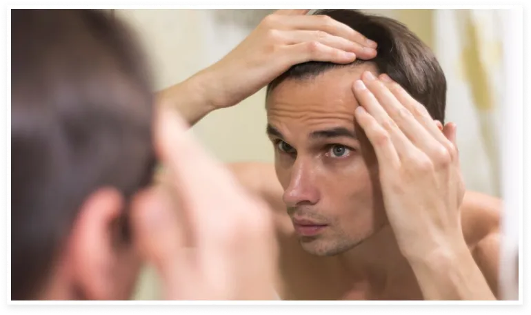 hombre observando que tiene alopecia androgénica